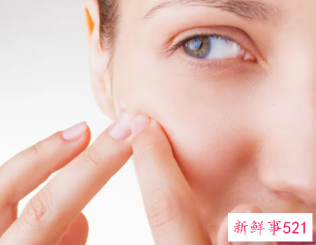 避孕药真的能治痘痘吗