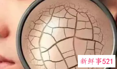 脸部缺水怎么办