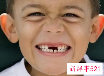 梦见掉牙破解方法