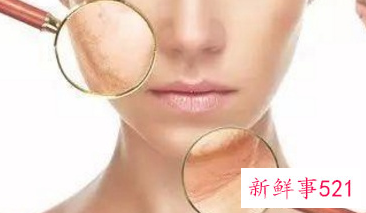 激光祛斑4次了越来越严重