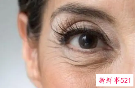 眼部如何除皱