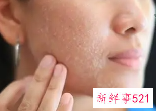 去角质方法都有哪些