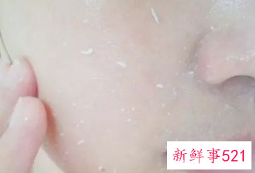 去角质方法都有哪些