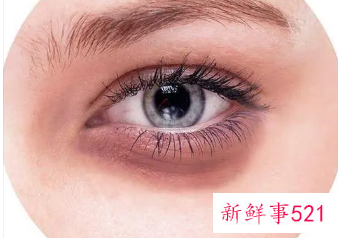 日常生活怎样淡化黑眼圈