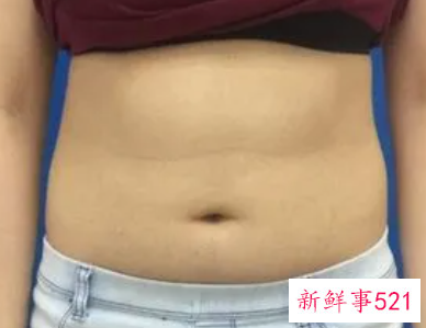 肚子减肥有效的方法