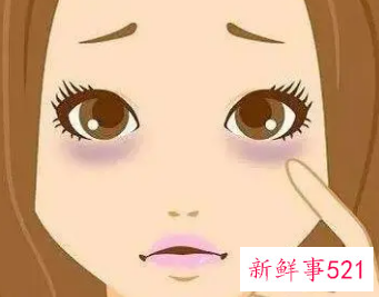 日常生活怎样淡化黑眼圈