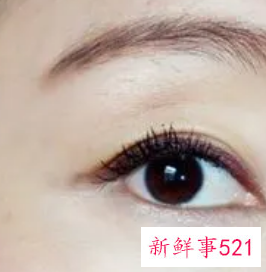 有没有睫毛快速生长的方法