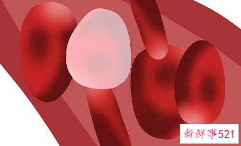 b12维生素缺乏的症状