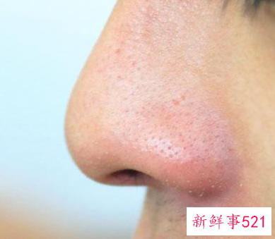 b12维生素缺乏的症状