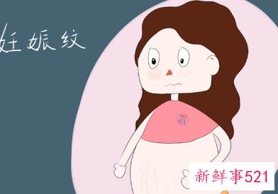 肚子孕辰纹能去掉吗