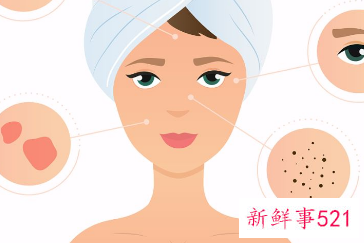 斑和皱纹是怎么形成的