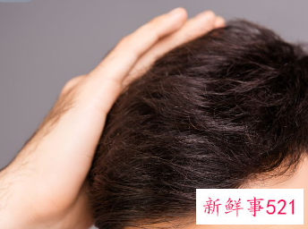 补肾一个月可以让白发变黑