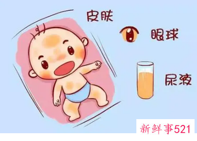 新生儿正常的表现有哪些