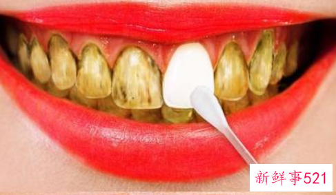 黄牙如何快速变白