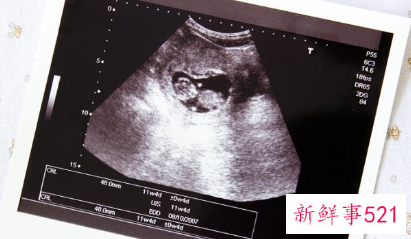 怀孕从哪里可以看出来男女