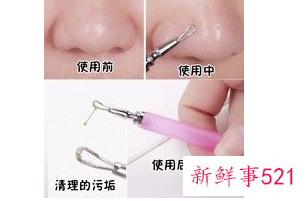 鼻子爱出油毛孔粗大有黑头