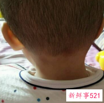 婴儿总往一边歪脖