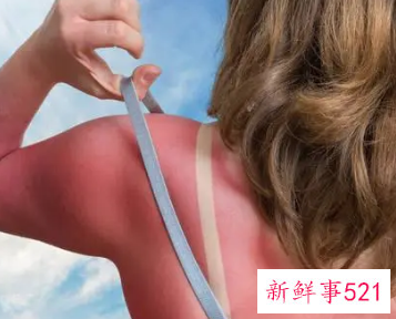 晒黑了有什么好处