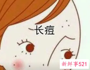 哪种痘痘是内分泌失调图片