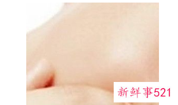 鼻子爱出油毛孔粗大有黑头