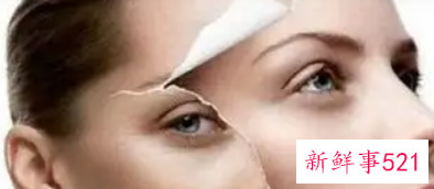 面部暗淡发黄怎么调理