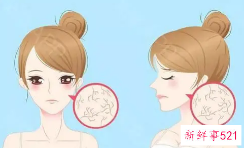 冬季皮肤干燥该怎么办