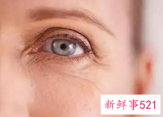眼部皱纹怎么引起的