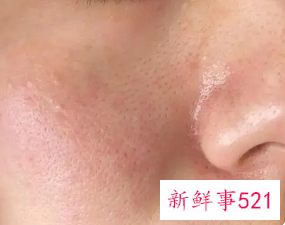 夏天肌肤出油多控油的三大误区