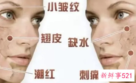 脸部缺水刺痛如何处理