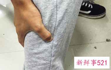 静脉曲张的危害有哪些