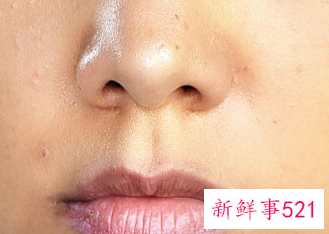 全身皮肤变粗糙什么问题