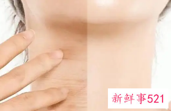 皮肤晒黑怎么变白的妙招