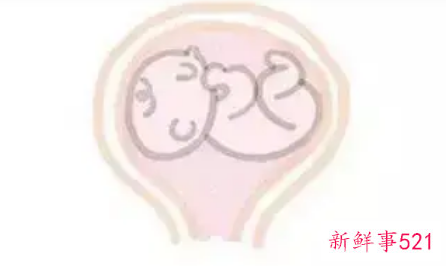 胎儿位置不好怎么调整