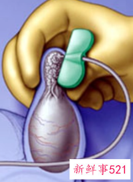 睾丸怎么补才能提高性功能吃什么中药处方