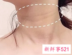 没有颈纹的秘诀