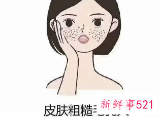 怎么改善皮肤毛孔粗大黑头