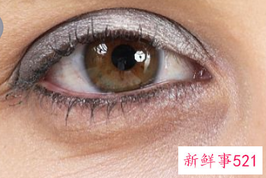 三天去除黑眼圈小妙招