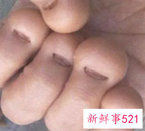 孩子爱咬手指甲是什么原因