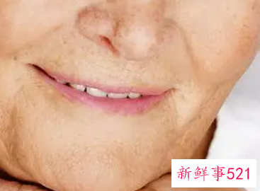 38岁脸部下垂怎样改善