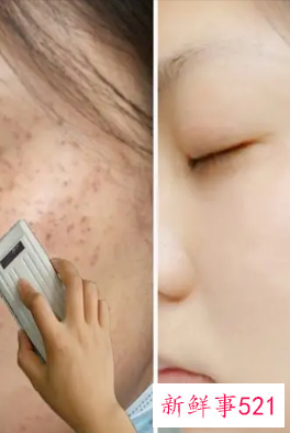 如何祛黄提亮肤色