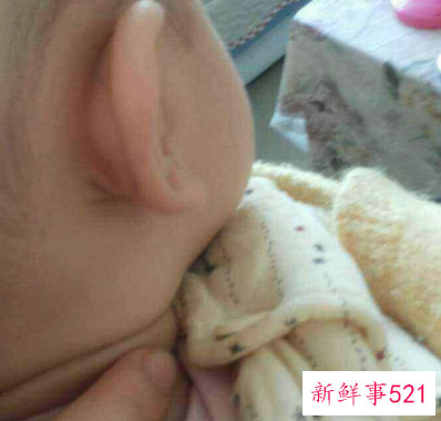 宝宝脖子歪右边纠正图