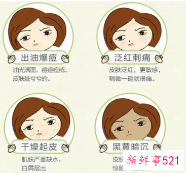 补水可以祛痘印吗