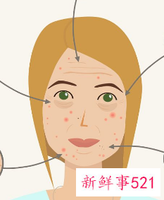 祛斑以后要注意事项