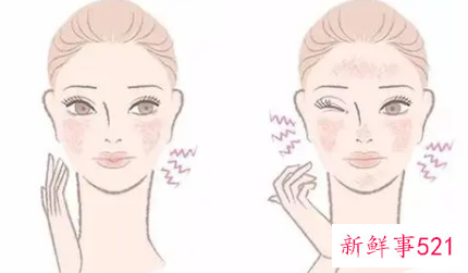 皮肤干燥什么原因