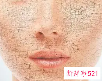 皮肤缺水后有哪些肌肤问题