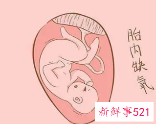 1小时胎动12次是缺氧吗