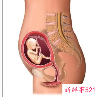 梦见自己打胎有什么征兆