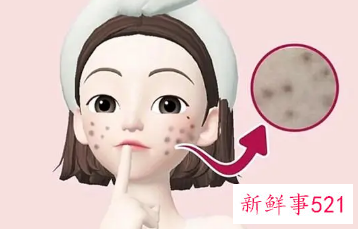 皮肤上的痘印怎么消除