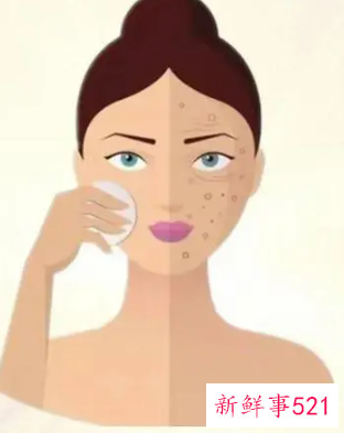 如何拥有一个好皮肤