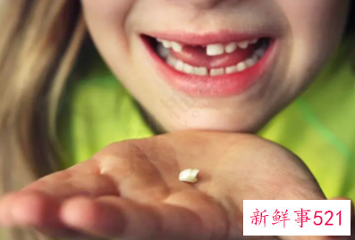 儿童换牙要注意哪些事项